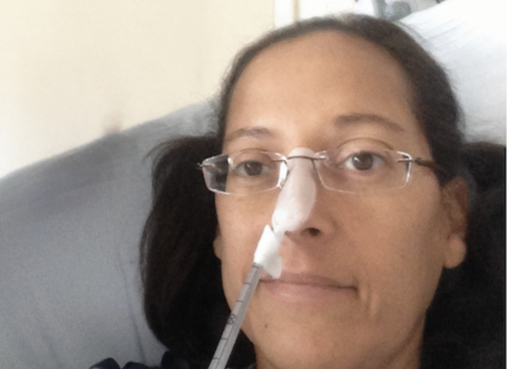 Dr. Yvette Colón after her diagnosis and Whipple procedure needing the help of an NG tube. 